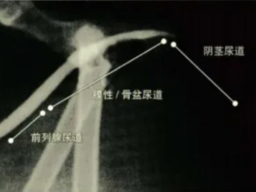 公猫反复尿闭、尿道堵塞？一篇看懂