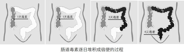 君康能阳光精华温暖腹部