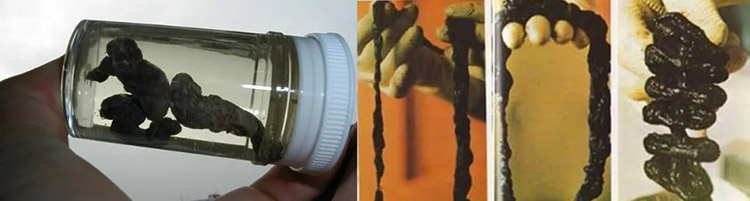 君康能阳光精华温暖腹部