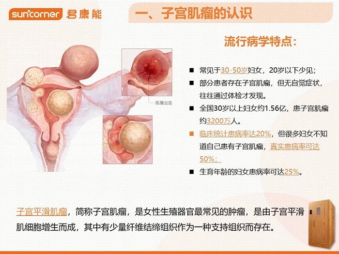 【君康能福利日】子宫肌瘤，20%的成年女性都有！