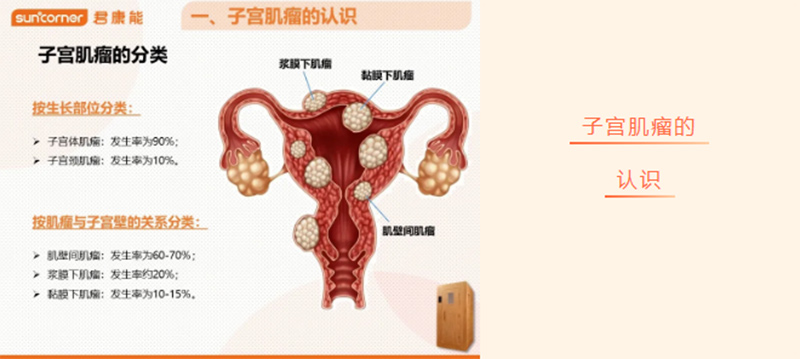 【君康能福利日】子宫肌瘤，20%的成年女性都有！
