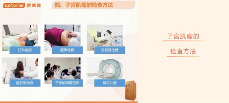 【君康能福利日】子宫肌瘤，20%的成年女性都有！