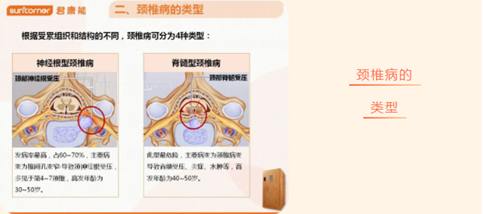 君康能会员福利日丨颈椎病分十级，来测测你属于哪一级！