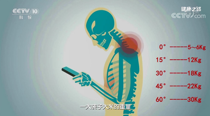 有这5个坏习惯，难怪你的颈椎一直难受，别等长期发病了才后悔！