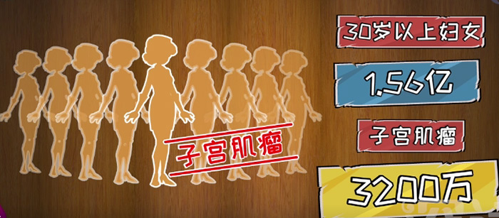 【女性必看！】子宫肌瘤——每5个女人，就有1个中招！