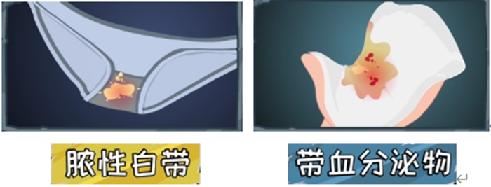 【女性必看！】子宫肌瘤——每5个女人，就有1个中招！