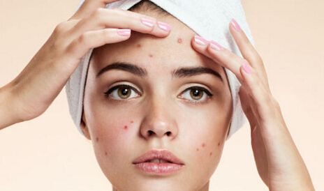 脸部螨虫过敏怎么办