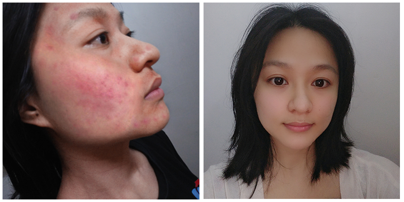 昕妍老师肌肤改善前后对比图