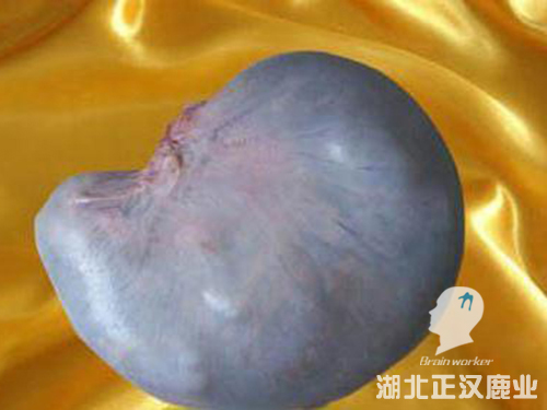 鹿胎
